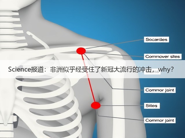 Science报道：非洲似乎经受住了新冠大流行的冲击，why？(图2)