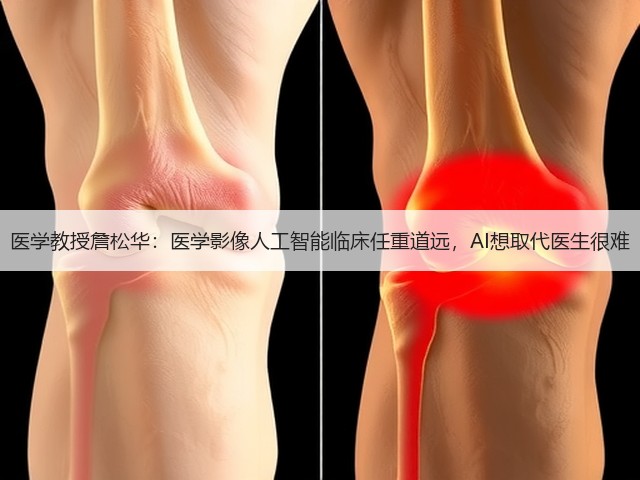 医学教授詹松华:医学影像人工智能临床任重道远,AI想取代医生很难(图3) 医学教授詹松华:医学影像人工智能临床任重道远,AI想取代医生很难(图3)