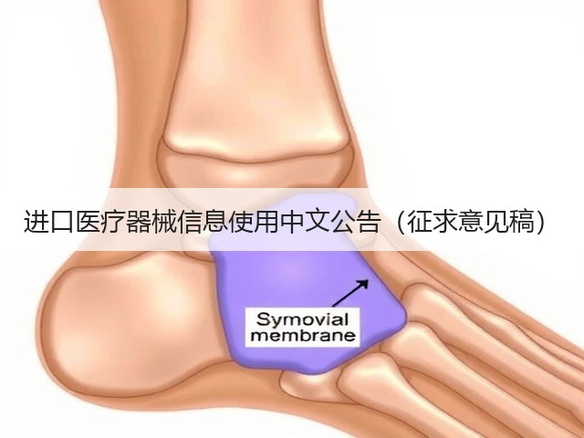 进口医疗器械信息使用中文公告(征求意见稿)(图2) 进口医疗器械信息使用中文公告(征求意见稿)(图2)