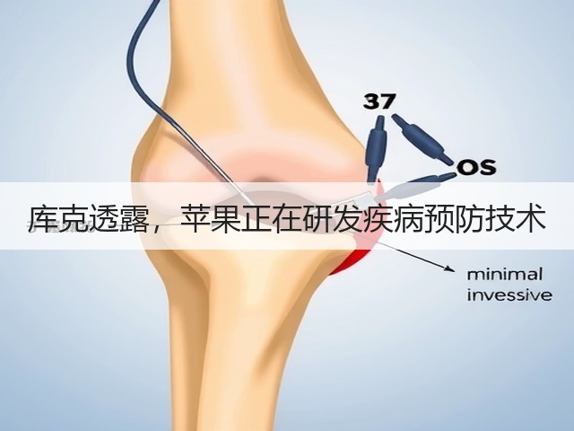 库克透露,苹果正在研发疾病预防技术(图3) 库克透露,苹果正在研发疾病预防技术(图3)
