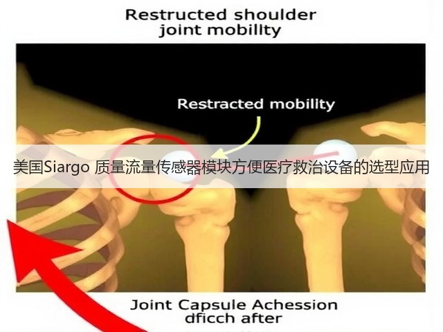 美国Siargo 质量流量传感器模块方便医疗救治设备的选型应用(图1)