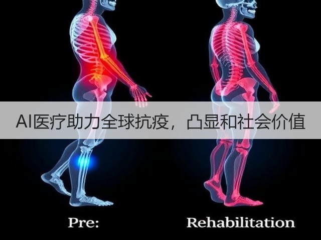AI医疗助力全球抗疫,凸显和社会价值(图3) AI医疗助力全球抗疫,凸显和社会价值(图3)
