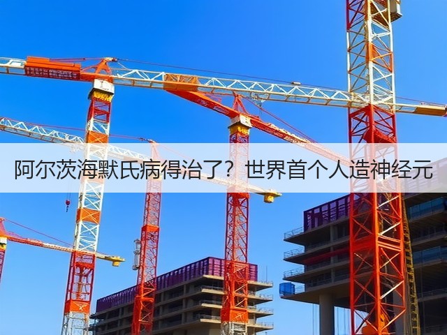 阿尔茨海默氏病得治了?世界首个人造神经元(图3) 阿尔茨海默氏病得治了?世界首个人造神经元(图3)
