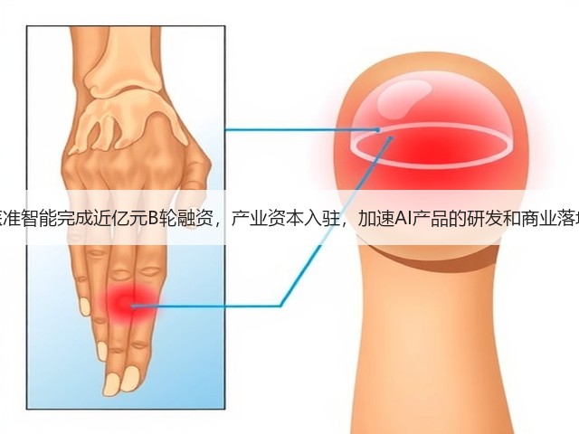 医准智能完成近亿元B轮融资,产业资本入驻,加速AI产品的研发和商业落地(图1) 医准智能完成近亿元B轮融资,产业资本入驻,加速AI产品的研发和商业落地(图1)