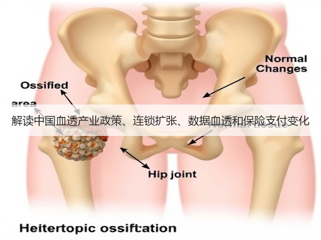 解读中国血透产业政策、连锁扩张、数据血透和保险支付变化(图1) 解读中国血透产业政策、连锁扩张、数据血透和保险支付变化(图1)