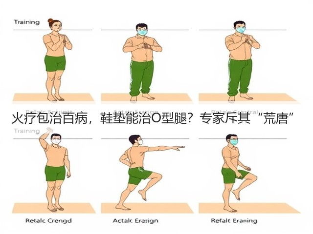 火疗包治百病,鞋垫能治O型腿?专家斥其“荒唐”(图2) 火疗包治百病,鞋垫能治O型腿?专家斥其“荒唐”(图2)