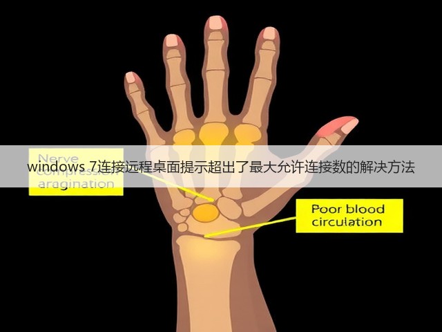 windows 7连接远程桌面提示超出了最大允许连接数的解决方法(图2) windows 7连接远程桌面提示超出了最大允许连接数的解决方法(图2)