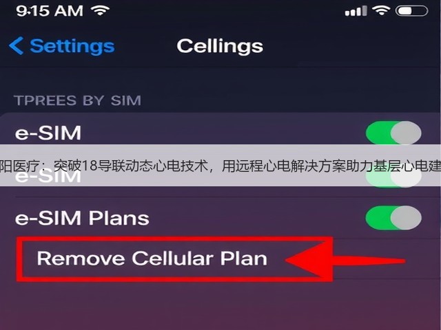 蓬阳医疗:突破18导联动态心电技术,用远程心电解决方案助力基层心电建设(图3) 蓬阳医疗:突破18导联动态心电技术,用远程心电解决方案助力基层心电建设(图3)