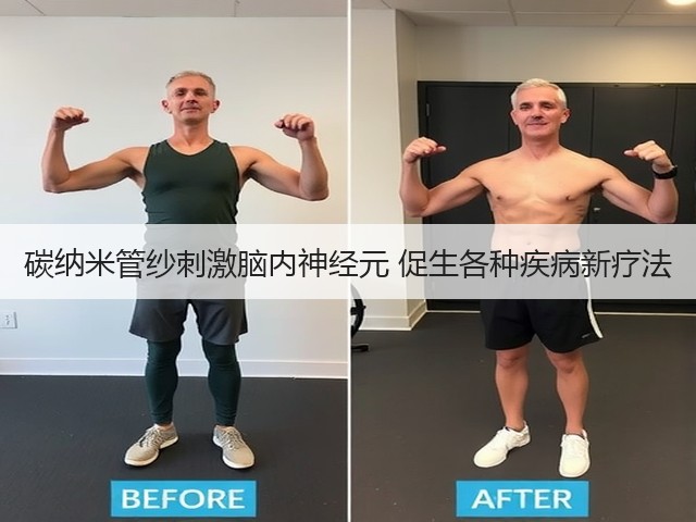 碳纳米管纱刺激脑内神经元 促生各种疾病新疗法(图2) 碳纳米管纱刺激脑内神经元 促生各种疾病新疗法(图2)
