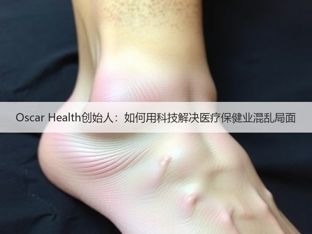 Oscar Health创始人:如何用科技解决医疗保健业混乱局面(图2) Oscar Health创始人:如何用科技解决医疗保健业混乱局面(图2)