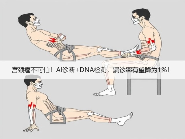 宫颈癌不可怕！AI诊断+DNA检测，漏诊率有望降为1%！(图2)