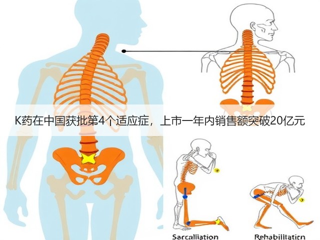 K药在中国获批第4个适应症,上市一年内销售额突破20亿元(图2) K药在中国获批第4个适应症,上市一年内销售额突破20亿元(图2)