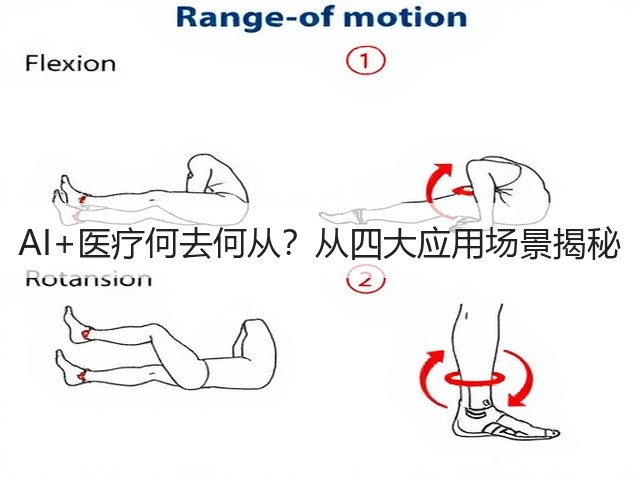 AI+医疗何去何从?从四大应用场景揭秘(图1) AI+医疗何去何从?从四大应用场景揭秘(图1)