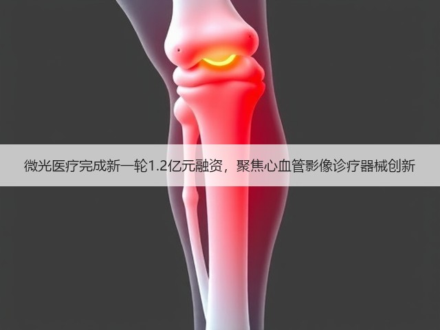 微光医疗完成新一轮1.2亿元融资,聚焦心血管影像诊疗器械创新(图3) 微光医疗完成新一轮1.2亿元融资,聚焦心血管影像诊疗器械创新(图3)