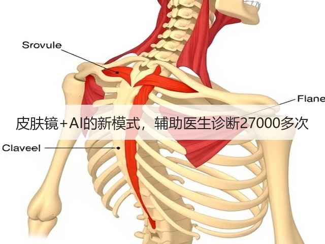 皮肤镜+AI的新模式,辅助医生诊断27000多次(图1) 皮肤镜+AI的新模式,辅助医生诊断27000多次(图1)