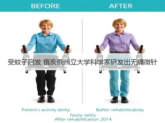受蚊子启发 俄亥俄州立大学科学家研发出无痛微针(图1) 受蚊子启发 俄亥俄州立大学科学家研发出无痛微针(图1)