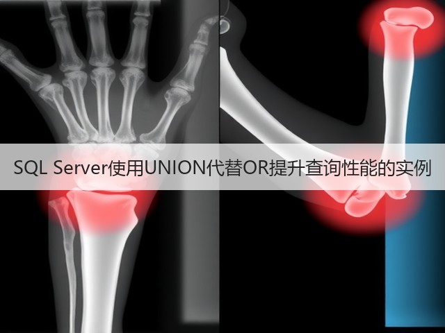 SQL Server使用UNION代替OR提升查询性能的实例(图1) SQL Server使用UNION代替OR提升查询性能的实例(图1)