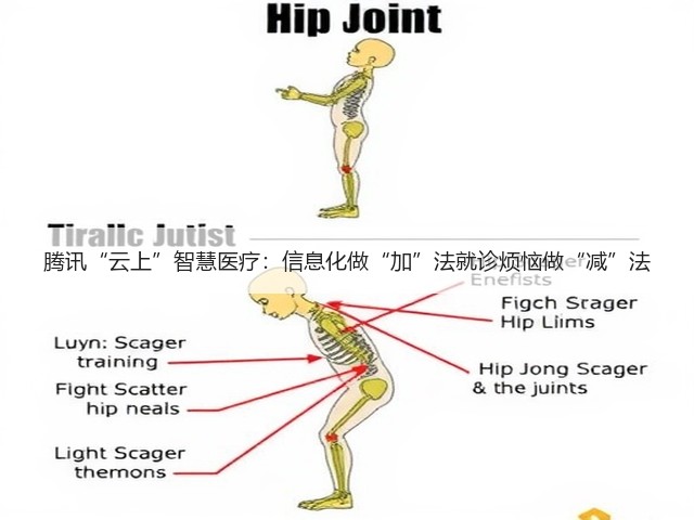 腾讯“云上”智慧医疗:信息化做“加”法就诊烦恼做“减”法(图3) 腾讯“云上”智慧医疗:信息化做“加”法就诊烦恼做“减”法(图3)
