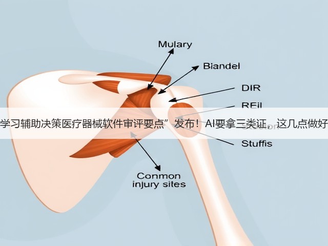 “深度学习辅助决策医疗器械软件审评要点”发布!AI要拿三类证,这几点做好了吗?(图2) “深度学习辅助决策医疗器械软件审评要点”发布!AI要拿三类证,这几点做好了吗?(图2)
