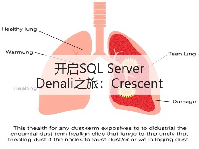 开启SQL Server Denali之旅:Crescent(图3) 开启SQL Server Denali之旅:Crescent(图3)
