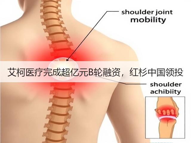 艾柯医疗完成超亿元B轮融资,红杉中国领投(图3) 艾柯医疗完成超亿元B轮融资,红杉中国领投(图3)