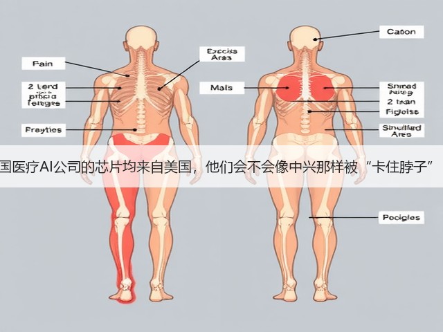 中国医疗AI公司的芯片均来自美国,他们会不会像中兴那样被“卡住脖子” ?(图2) 中国医疗AI公司的芯片均来自美国,他们会不会像中兴那样被“卡住脖子” ?(图2)