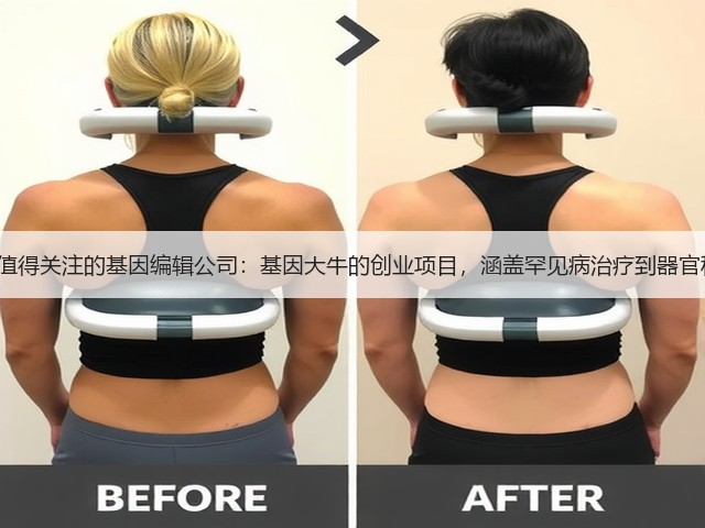 8家值得关注的基因编辑公司:基因大牛的创业项目,涵盖罕见病治疗到器官移植(图3) 8家值得关注的基因编辑公司:基因大牛的创业项目,涵盖罕见病治疗到器官移植(图3)