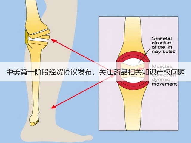 中美第一阶段经贸协议发布,关注药品相关知识产权问题(图1) 中美第一阶段经贸协议发布,关注药品相关知识产权问题(图1)