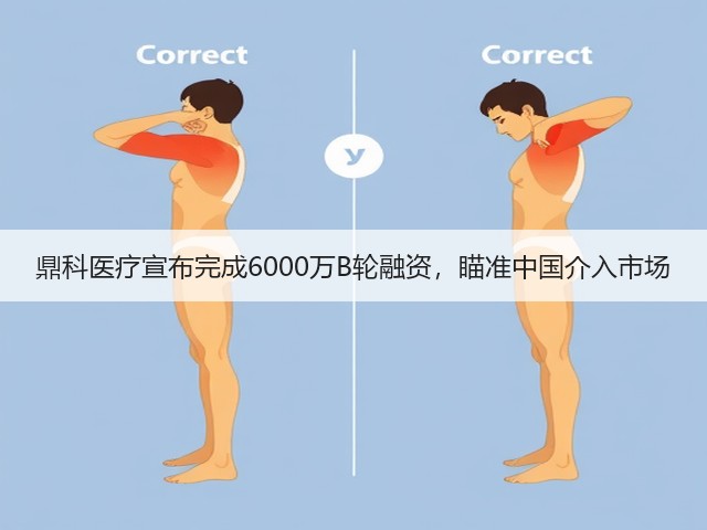 鼎科医疗宣布完成6000万B轮融资,瞄准中国介入市场(图3) 鼎科医疗宣布完成6000万B轮融资,瞄准中国介入市场(图3)