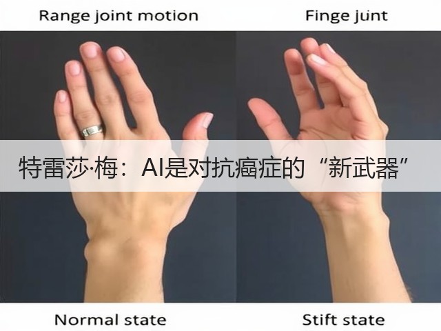 特雷莎·梅:AI是对抗癌症的“新武器”(图1) 特雷莎·梅:AI是对抗癌症的“新武器”(图1)