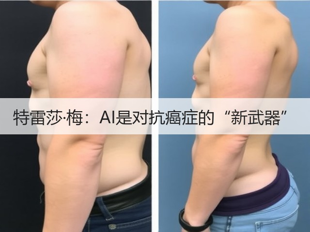 特雷莎·梅:AI是对抗癌症的“新武器”(图2) 特雷莎·梅:AI是对抗癌症的“新武器”(图2)